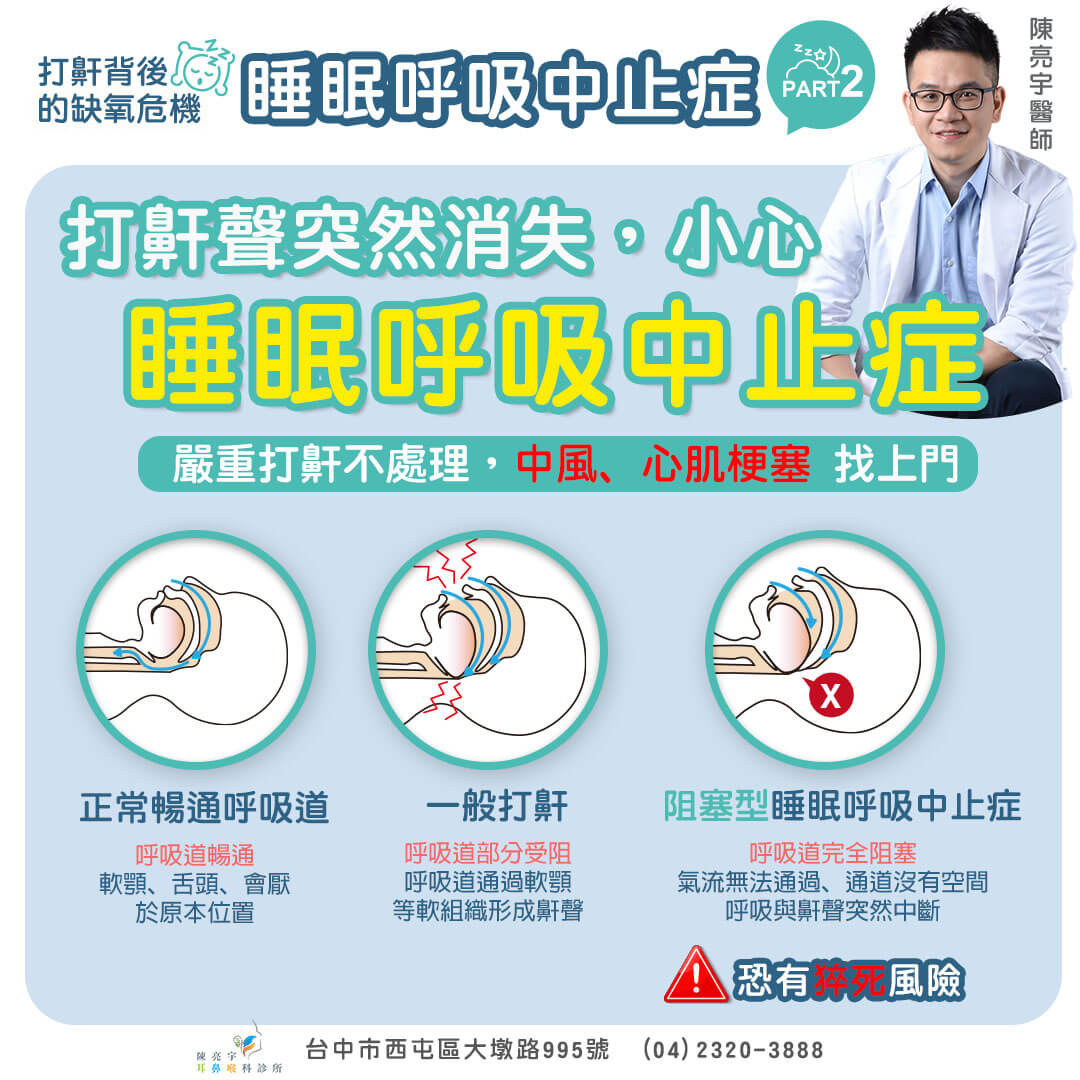 正常人vs打鼾者的呼吸道差別